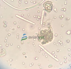 Diagnóstico de megabacterias en heces: Observación al microscopio de Macrorhabdus ornitogaster.